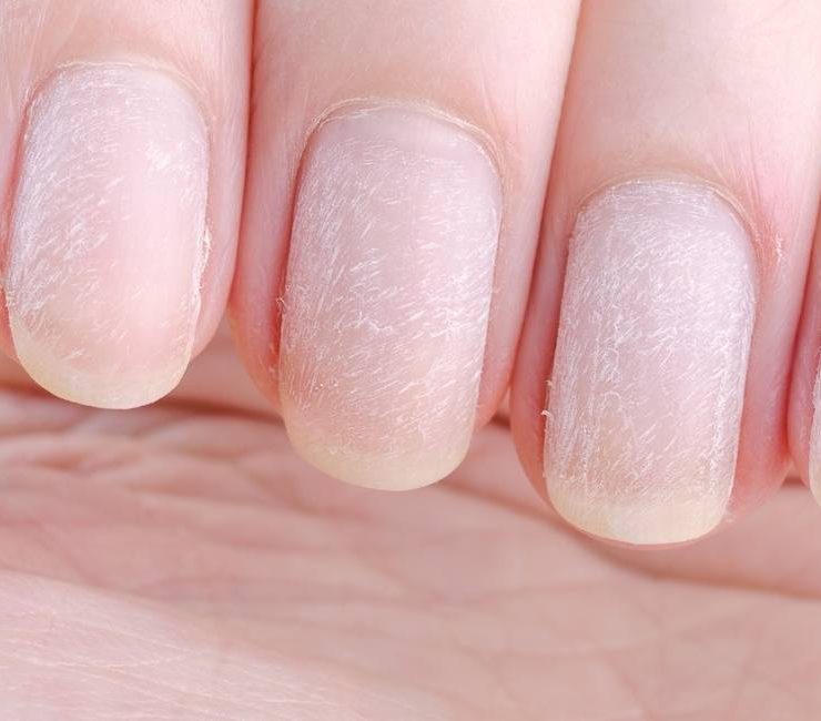 Dream about Nails Falling Off – 42 Plots and Meanings