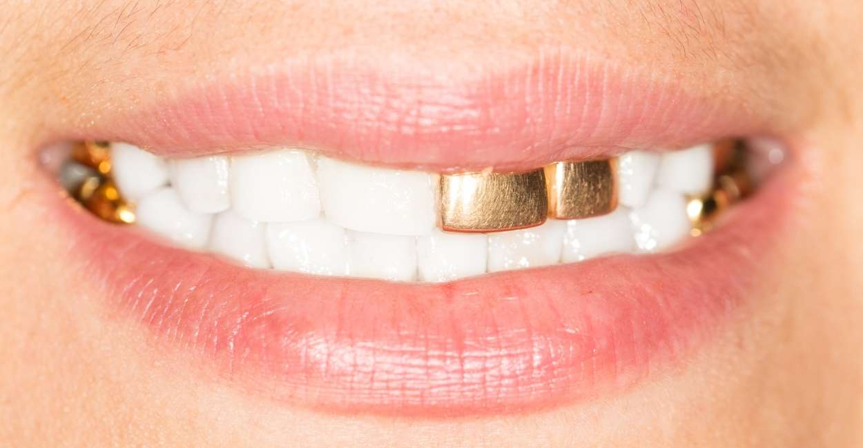 Dreaming of Gold Teeth – 20 Types & Their Interpretations