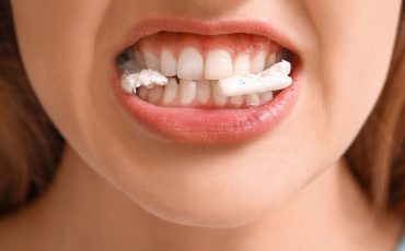 Dream about Gum Sticking to Teeth – Are You Currently Overlooking Problems?