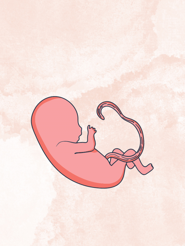 What Does A Dream Of Umbilical Cord Stand For?