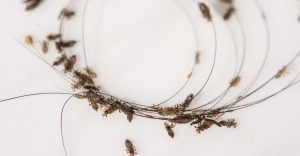Spiritual Meaning of Lice in a Dream – Is your head itchy