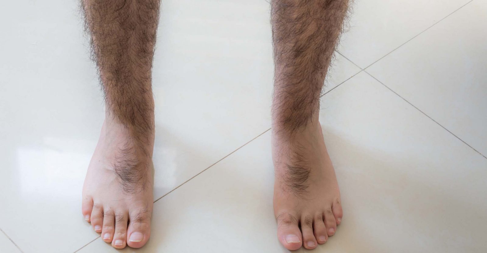 Dream of having Hairy Legs – 25 Types & their Interpretations