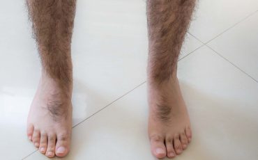 Dream of having Hairy Legs – 25 Types & their Interpretations